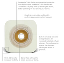 Convatec Natura Two-Piece Skin Barrier with Convatec Moldable Technology