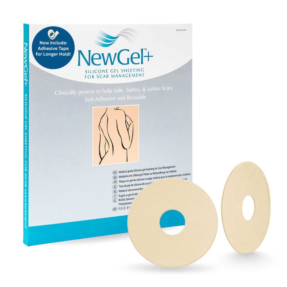 NG-120 NEWGEL+ AREOLA CIRCLES FOR BREAST SCARS - BEIGE (Discontinued)