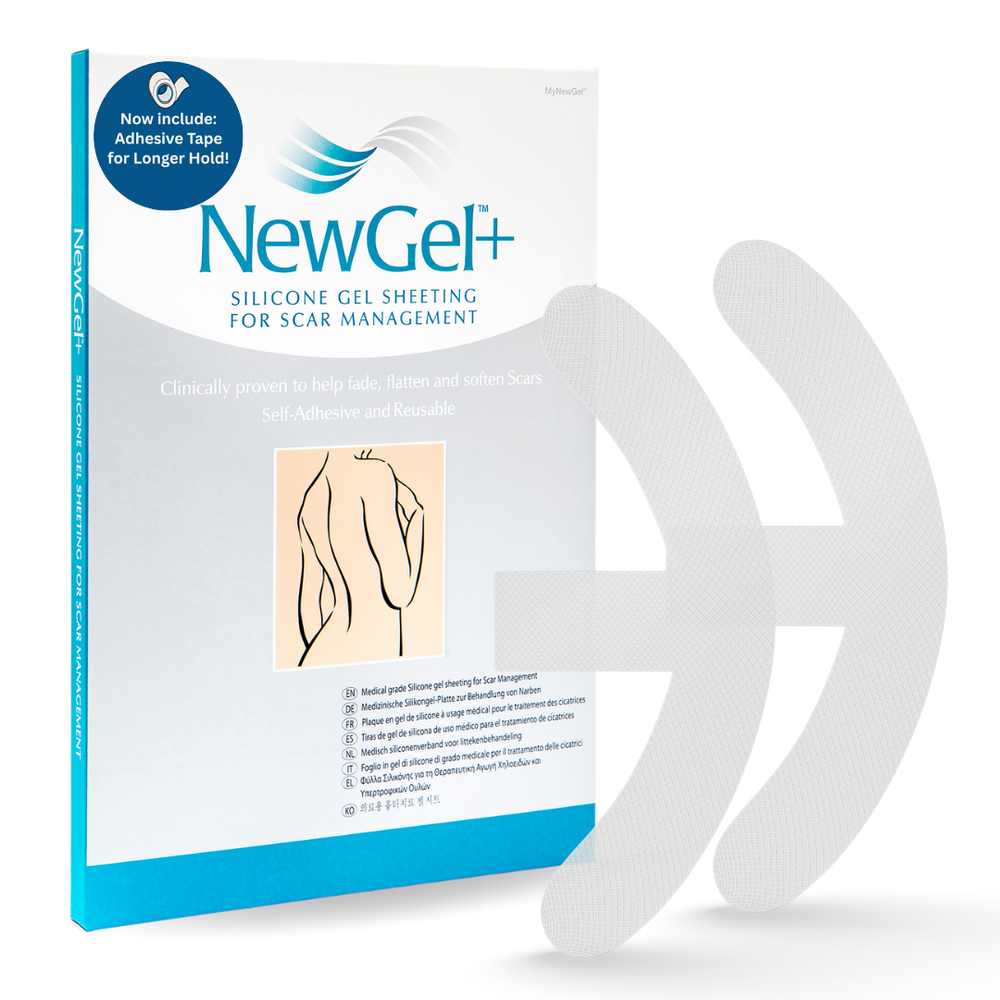 NG-326 NEWGEL+ ANCHORS FOR BREAST SCARS - CLEAR