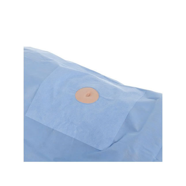 KC89206 Minor Procedure Drape, Fenestrated, 30" x 30", 100EA/CA